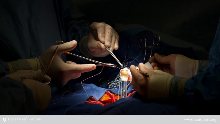 Trasplante cardíaco The Texas Heart Institute®
