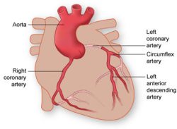 Coronary Arteries Texas Heart Institute
