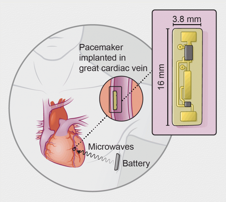 Texas team debuts batteryless pacemaker Texas Heart Institute