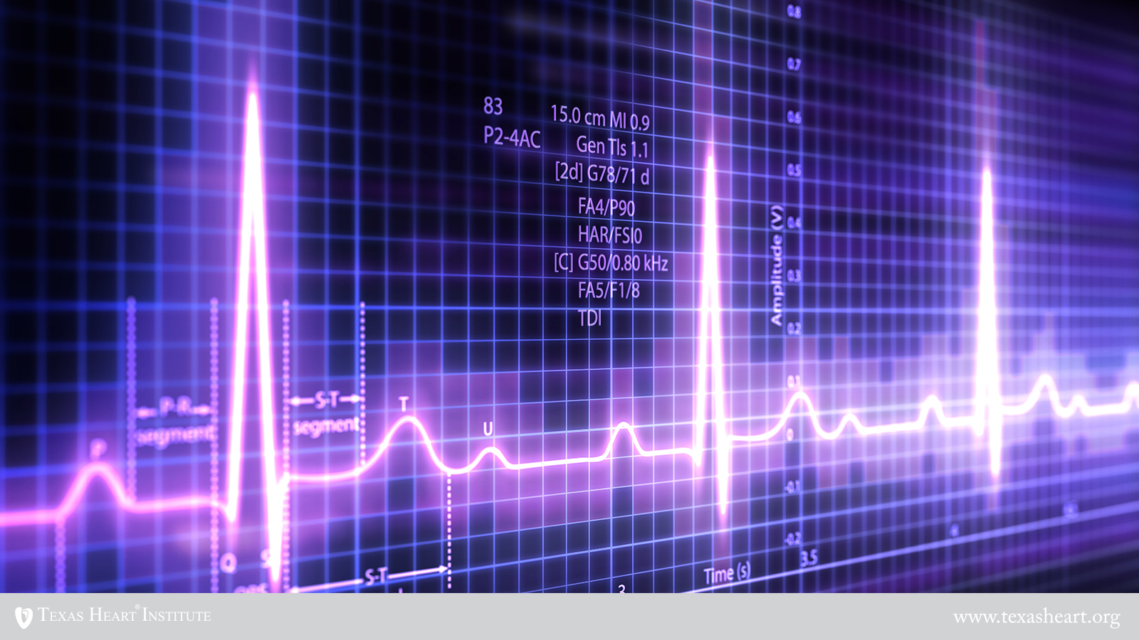 Electrocardiogram | Texas Heart Institute