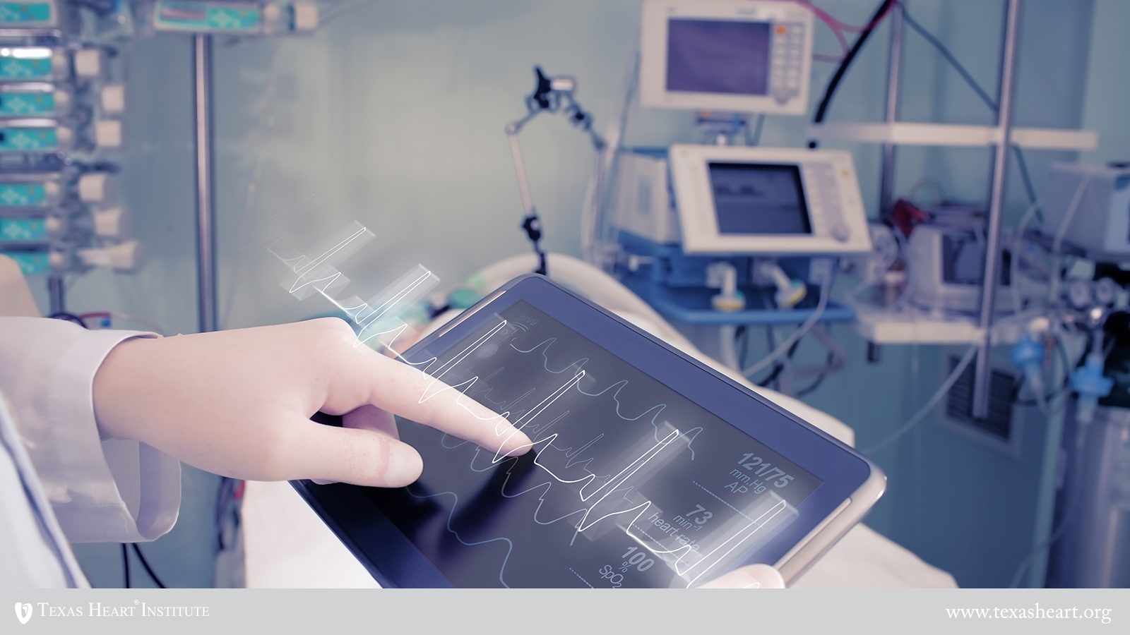 Bundle Branch Block heart rhythm