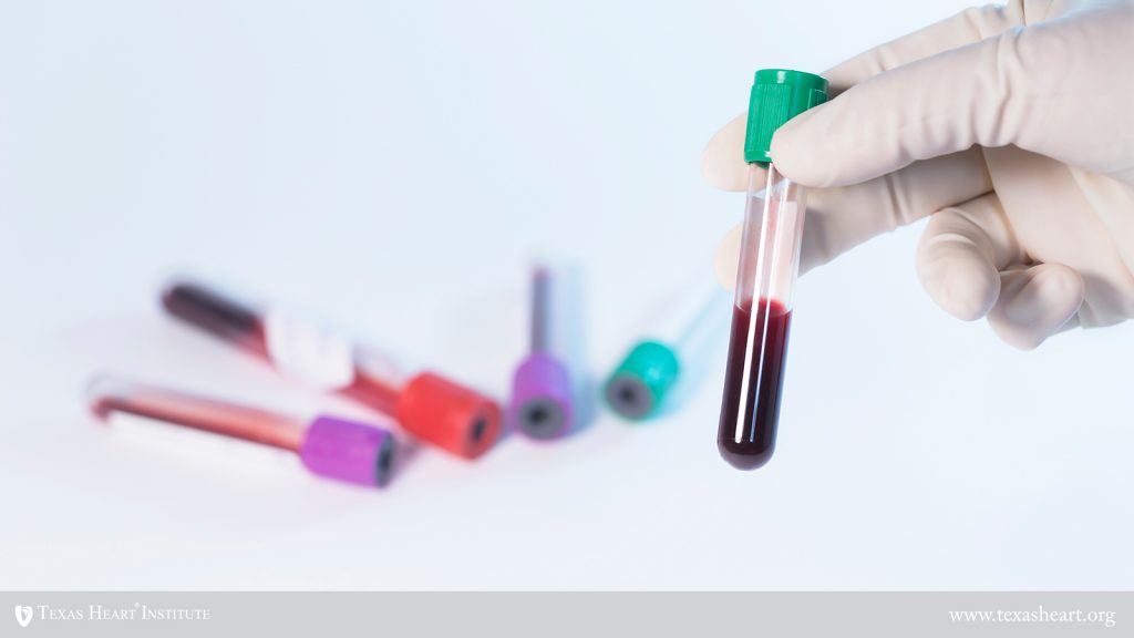 Two siRNA Therapeutics Safely Lower Triglycerides in Mixed