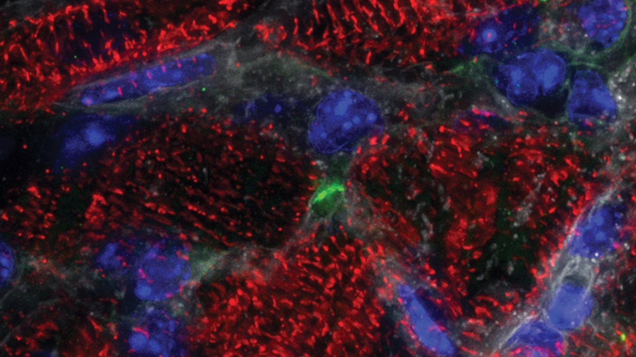 Dividing adult cardiomyocytes (red). DNA (nuclei) are in blue, the cell division marker Aurora B is in green and cell membranes are in white.