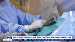Fox 26 Houston News about stem cells for the treatment of heart failure.